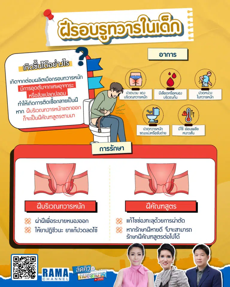 ฝีรอบรูทวารในเด็กเล็ก