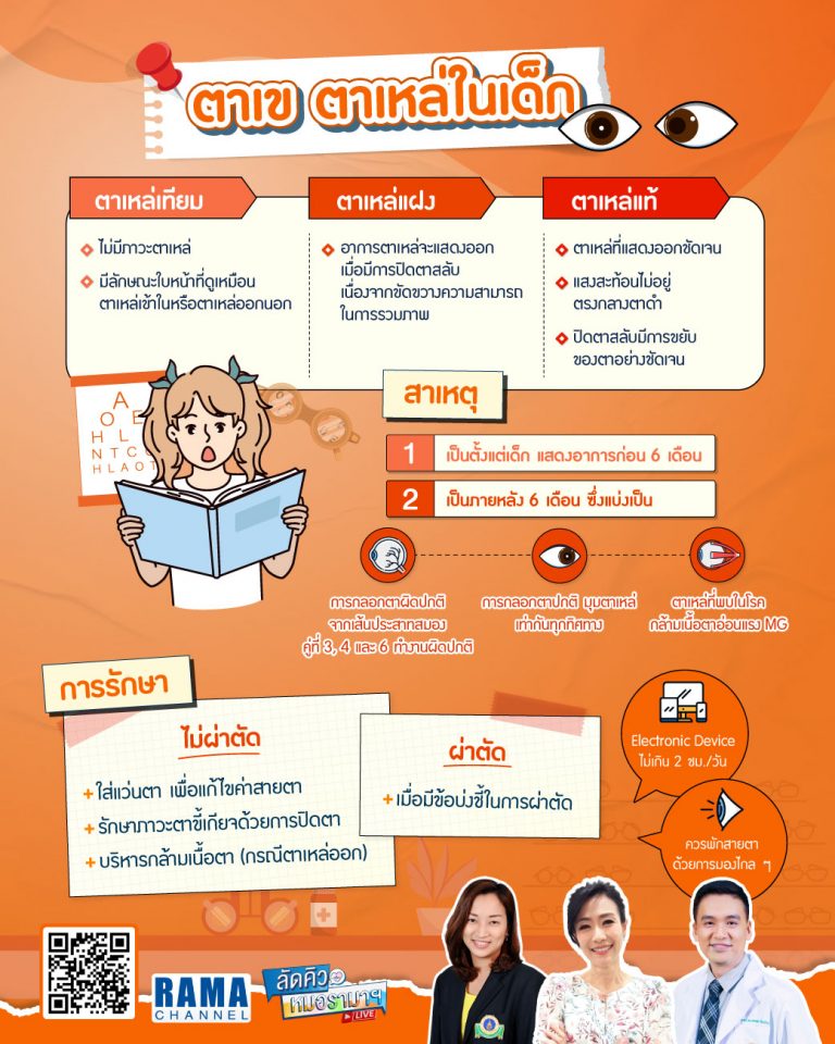 ตาเข ตาเหล่ในเด็ก