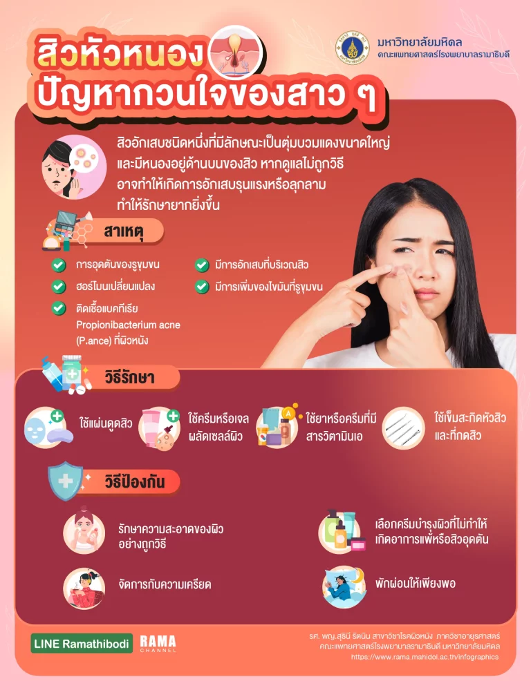 สิวหัวหนอง รักษา หรือหายได้เองไหม สิว