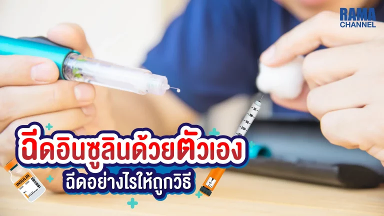 บทความเรื่อง การ ฉีดอินซูลินด้วยตัวเอง เป็นวิธีการรักษาที่แพทย์แนะนำให้แก่ผู้ป่วย โรคเบาหวาน เพราะจะสามารถช่วยรักษาสมดุลของระดับน้ำตาลในเลือดได้