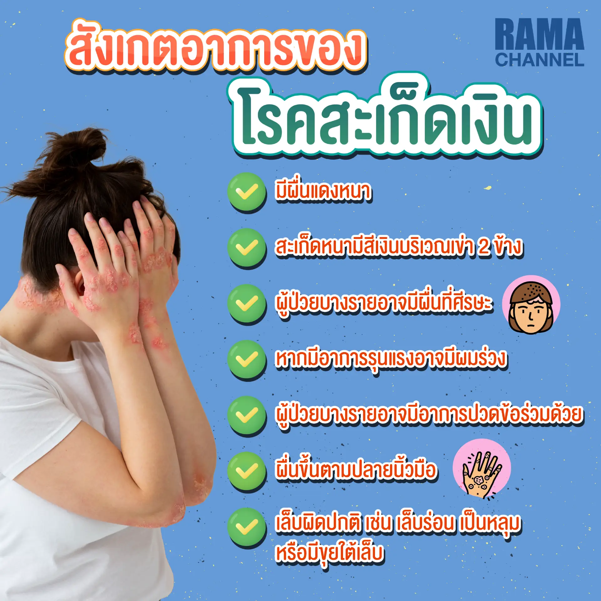 บทความเรื่อง โรคสะเก็ดเงิน เป็นโรค ผิวหนังอักเสบ เรื้อรังชนิดหนึ่ง ส่วนใหญ่มักจะมีอาการคัน ผิวหนังแดง มีขุยหนา แล้วโรค สะเก็ดเงิน รักษา อย่างไรได้บ้าง ?