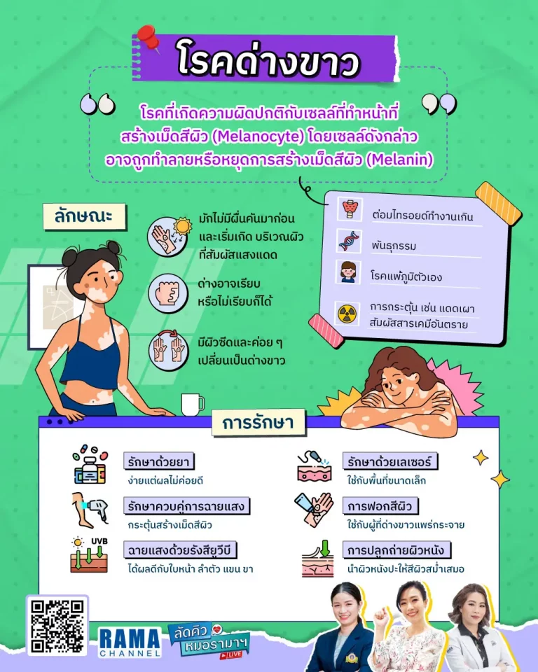 อินโฟกราฟิก เรื่อง โรค ด่างขาว เกิดจากความผิดปกติกับเซลล์ที่ทำหน้าที่สร้างเม็ดสีผิว (Melanocyte) โดยเซลล์ดังกล่าวอาจถูกทำลายหรือหยุดการสร้างเม็ดสีผิว (Melanin)