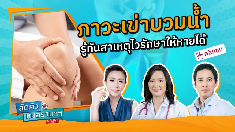 รายการลัดคิวหมอ เรื่อง ภาวะเข่าบวมน้ำ เกิดจากการระคายเคืองและอักเสบจากโรคบางชนิด เช่น โรครูมาตอยด์ โรคเกาท์ โรคซูโดเกาท์ และ โรคพุ่มพวง (SLE) เป็นต้น