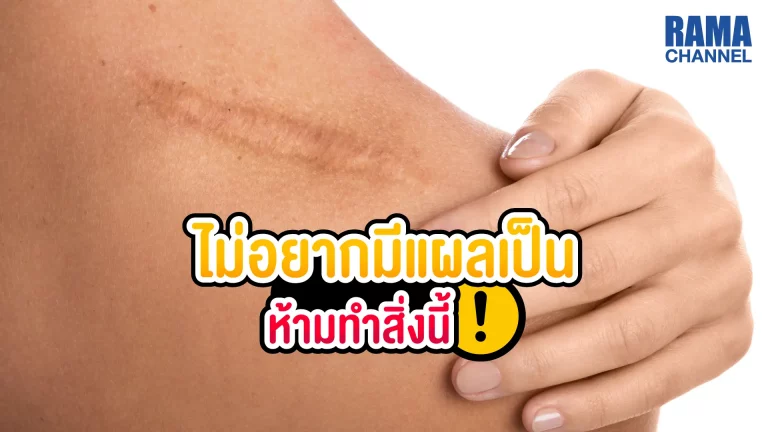 เมื่อเกิด รอยแผลเป็น ขึ้นบนผิวแล้วนั้นยากที่จะกำจัดให้หายไปจนหมด และหากดูแลแผลอย่างไม่ถูกต้องก็ยิ่งเป็นปัจจัยที่จะทำให้เกิดรอย แผลเป็น ได้อีก