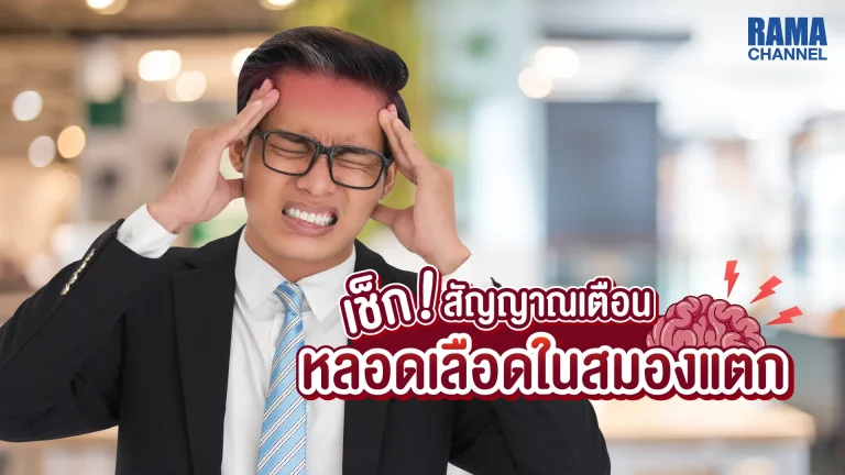หลอดเลือดสมองแตก หรือ เส้นเลือดในสมองแตก โรคที่เกิดจากความเสื่อมของหลอดเลือด มาจากอายุที่เพิ่มมากขึ้น นำไปสู่ภาวะการตีบ ตัน และแตกได้ในที่สุด