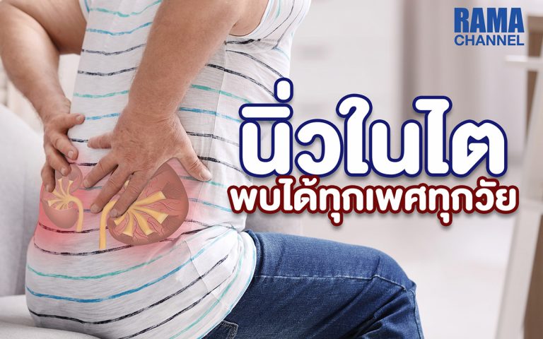 โรคนิ่วในไต ทำให้ปวดบั้นเอว ปัสสาวะขัด และเสี่ยงติดเชื้อ พบได้ทุกเพศทุกวัย ควรดื่มน้ำมากๆ และพบแพทย์เพื่อตรวจและรักษาแต่เนิ่นๆ