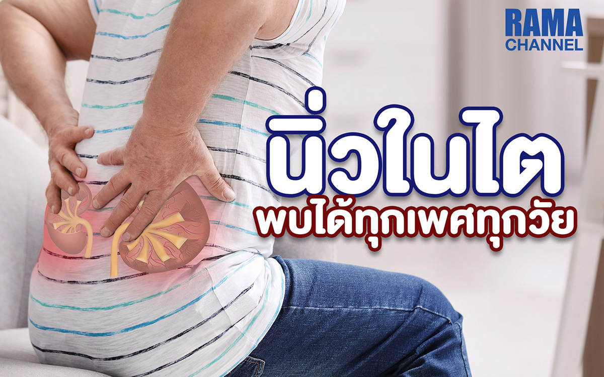 โรคนิ่วในไต ทำให้ปวดบั้นเอว ปัสสาวะขัด และเสี่ยงติดเชื้อ พบได้ทุกเพศทุกวัย ควรดื่มน้ำมากๆ และพบแพทย์เพื่อตรวจและรักษาแต่เนิ่นๆ