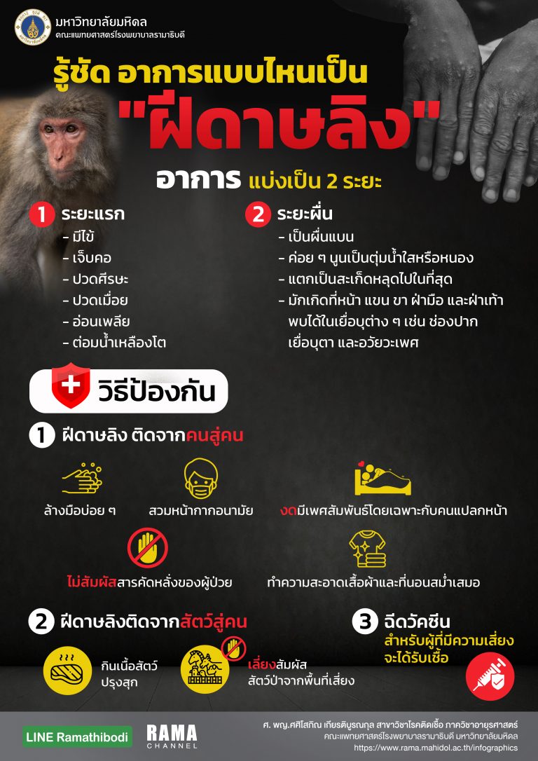Info new ฝีดาษลิง-01_0