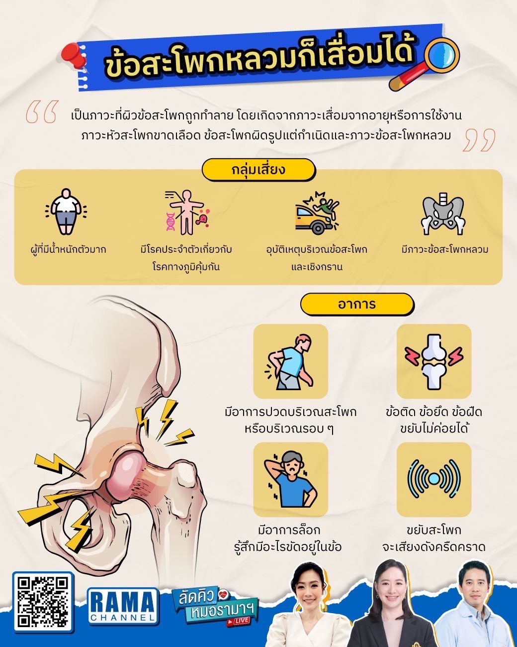 ข้อสะโพกหลวมก็เสื่อมได้