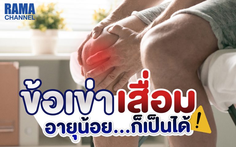 ข้อเข่าเสื่อม สามารถเกิดได้แม้ในวัยหนุ่มสาว หากใช้งานเข่าหนักหรือมีน้ำหนักเกิน ควรดูแลข้อเข่าและออกกำลังกายอย่างเหมาะสมเพื่อลดความเสี่ยง