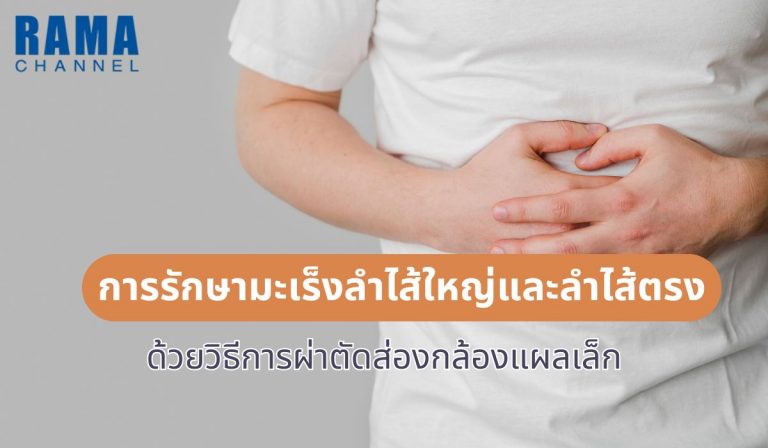 การรักษามะเร็งลำไส้ใหญ่ และลำไส้ตรง ด้วยวิธีการผ่าตัดส่องกล้องแผลเล็ก