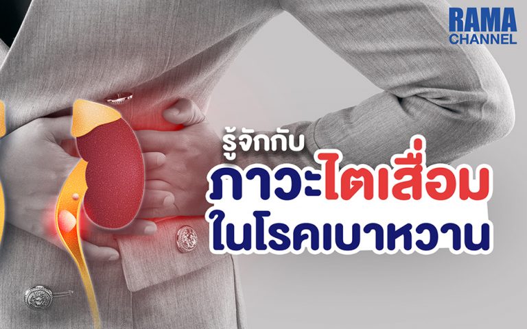 ภาวะไตเสื่อม จากโรคเบาหวานเกิดจากน้ำตาลในเลือดสูงทำลายไต ควรควบคุมระดับน้ำตาลและตรวจสุขภาพไตเป็นประจำเพื่อป้องกันภาวะแทรกซ้อน