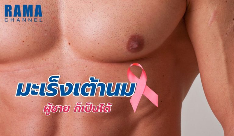มะเร็งเต้านมผู้ชาย ก็เป็นได้