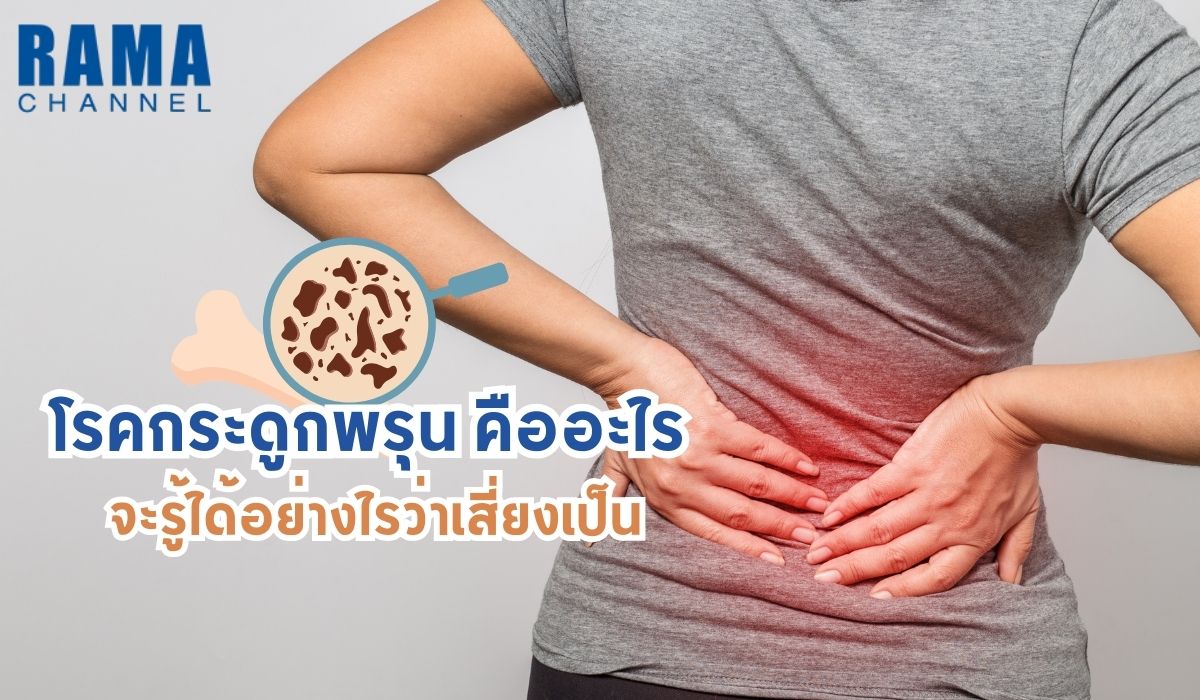โรคกระดูกพรุน คืออะไร จะรู้ได้อย่างไรว่าเสี่ยงเป็น