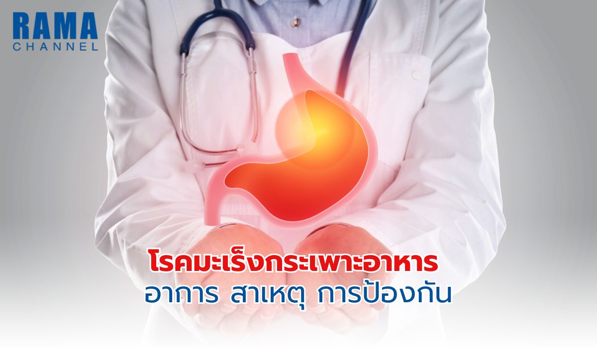 โรคมะเร็งกระเพาะอาหาร อาการ สาเหตุ การป้องกัน