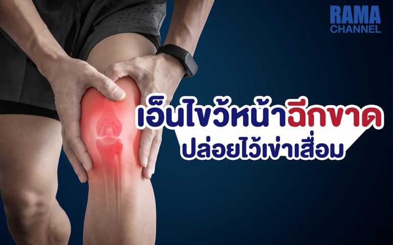 เอ็นไขว้หน้าฉีกขาด ปล่อยไว้เข่าเสื่อม