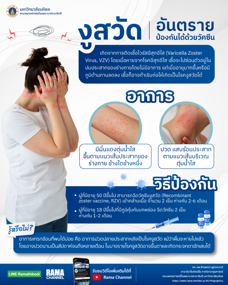 งูสวัด อันตรายป้องกันได้ด้วยวัคซีน
