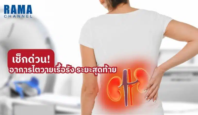 เช็กด่วน! อาการ ไตวายเรื้อรัง ระยะสุดท้าย