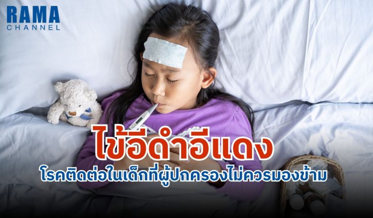 ไข้อีดำอีแดงเป็นโรคติดต่อในเด็กจากเชื้อแบคทีเรีย