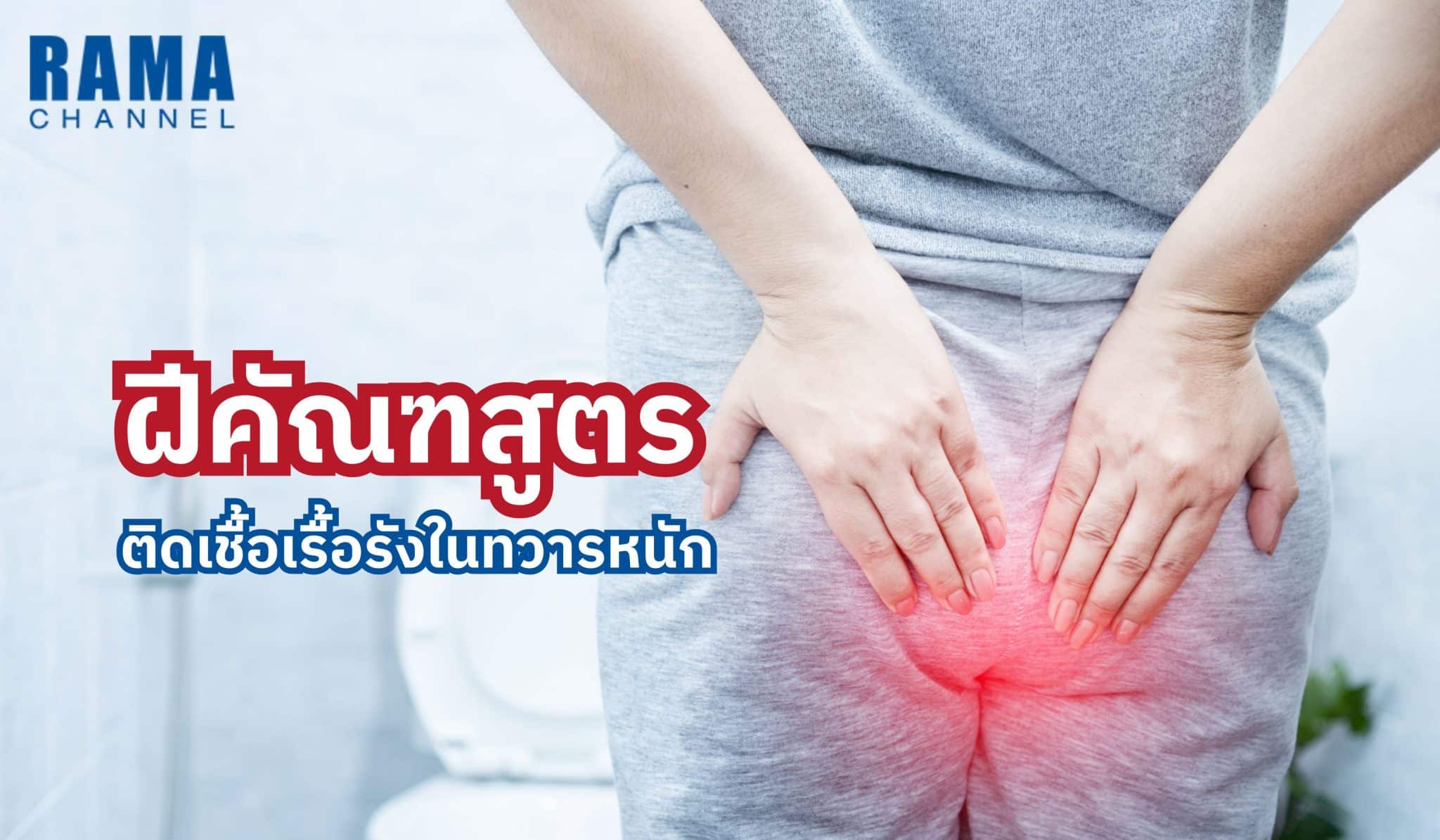ฝีคัณฑสูตร ติดเชื้อเรื้อรังในทวารหนัก