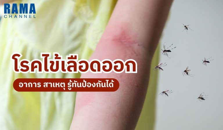 ไข้เลือดออกเกิดจากเชื้อไวรัสเด็งกี