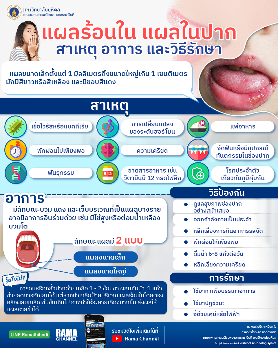 ร้อนในหรือแผลในปากเกิดจากภูมิคุ้มกันต่ำ