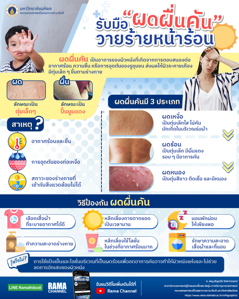 ผดผื่นคันในหน้าร้อนเกิดจากเหงื่อ