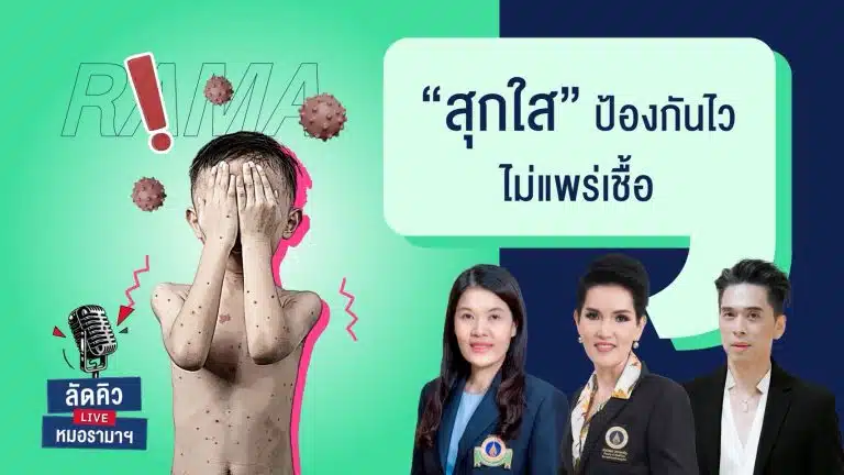 โรคสุกใสติดต่อได้ง่ายโดยเฉพาะในเด็ก
