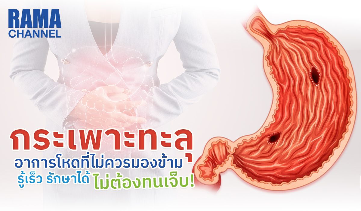 กระเพาะทะลุ อาการโหดที่ไม่ควรมองข้าม รู้เร็ว รักษาได้ ไม่ต้องทนเจ็บ!