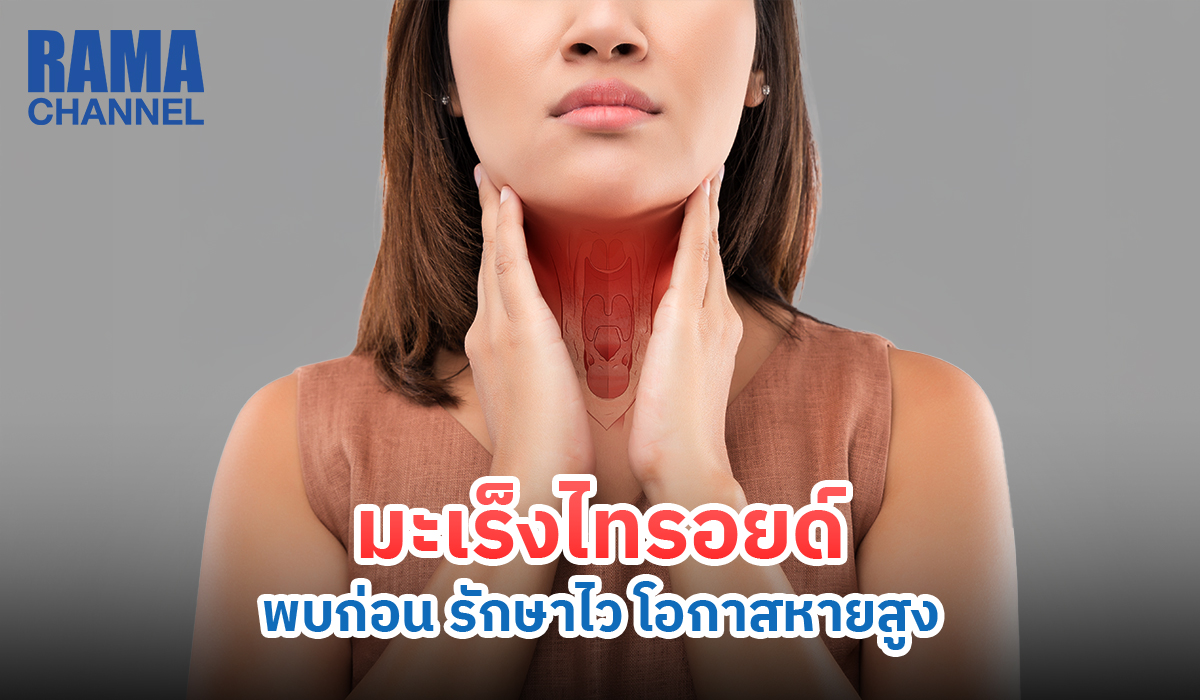 มะเร็งไทรอยด์มักไม่มีอาการในระยะแรก