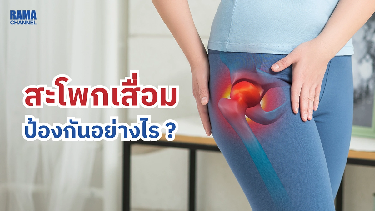 สะโพกเสื่อม ป้องกันอย่างไร