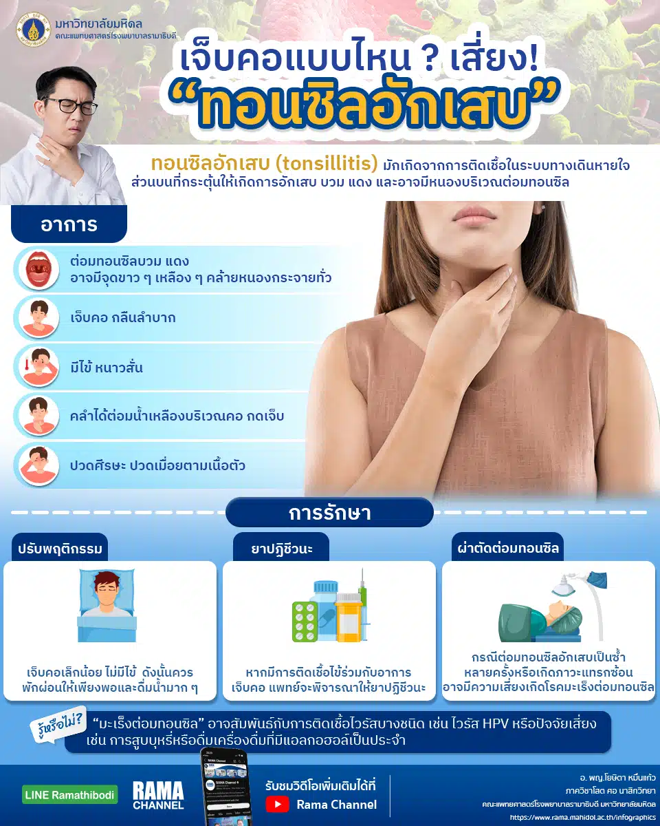 เจ็บคอแบบไหน เสี่ยงเป็นทอนซิลอักเสบ