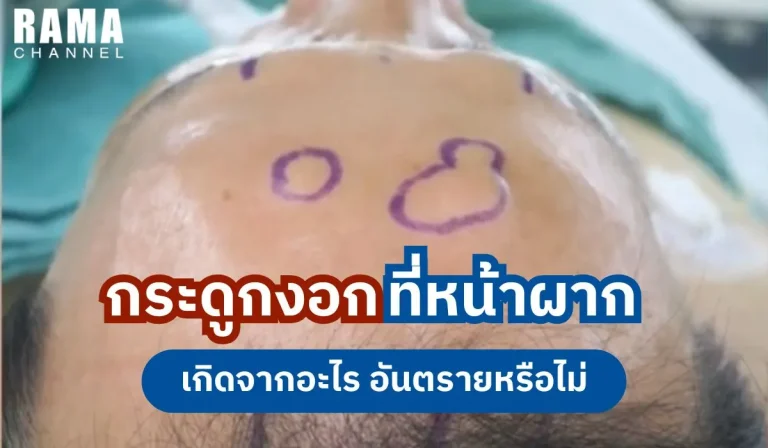 กระดูกงอกที่หน้าผากเกิดจากอะไร-อันตรายหรือไม่