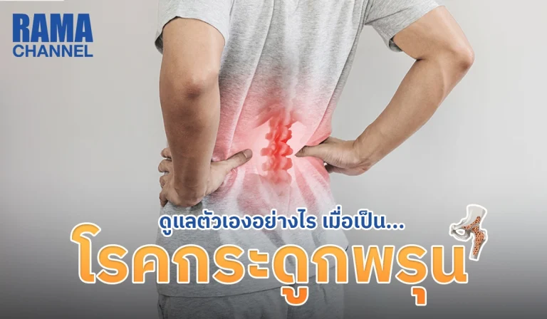 ดูแลตัวเองอย่างไร เมื่อเป็น โรคกระดูกพรุน