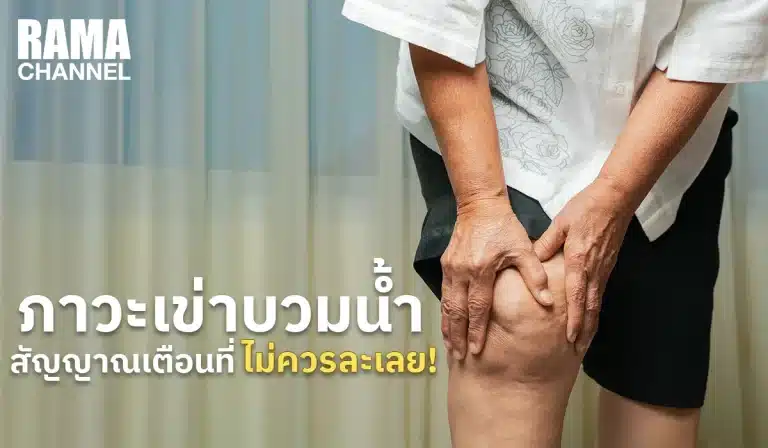 ภาวะเข่าบวมน้ำ สัญญาณเตือนที่ไม่ควรละเลย!