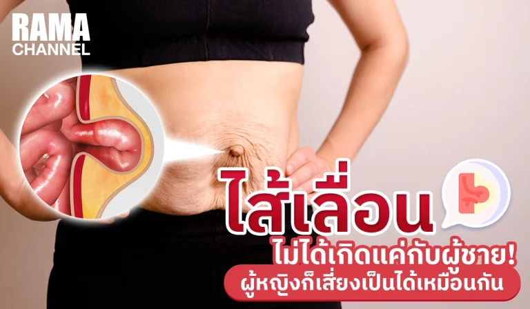 ไส้เลื่อน ไม่ได้เกิดแค่กับผู้ชาย!