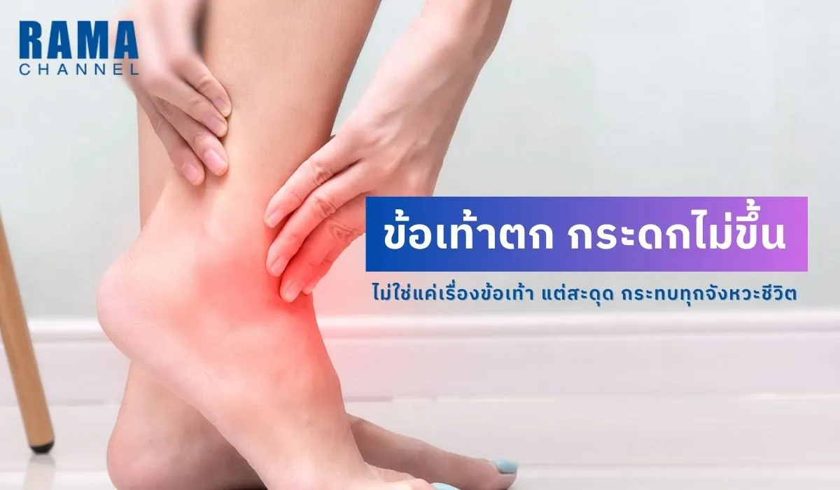 ข้อเท้าตก กระดกไม่ขึ้น ไม่ใช่แค่เรื่องข้อเท้า แต่สะดุด กระทบทุกจังหวะชีวิต
