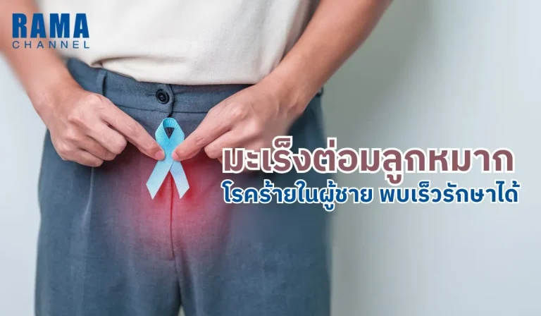 มะเร็งต่อมลูกหมาก โรคร้ายในผู้ชาย พบเร็วรักษาได้