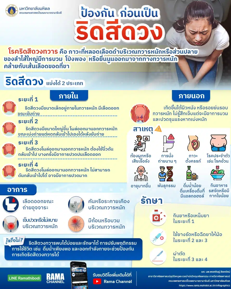 ริดสีดวงทวารป้องกันได้ด้วยการดูแลสุขภาพง่าย ๆ