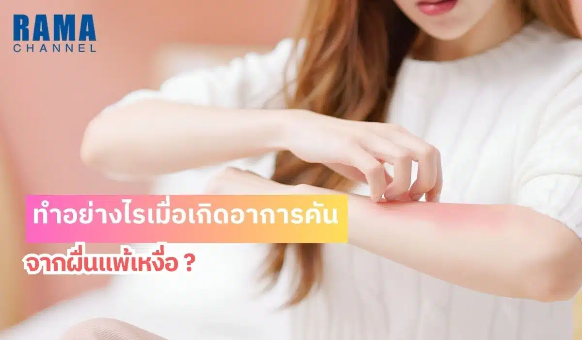 ทำอย่างไรเมื่อเกิดอาการคัน จากผื่นแพ้เหงื่อ