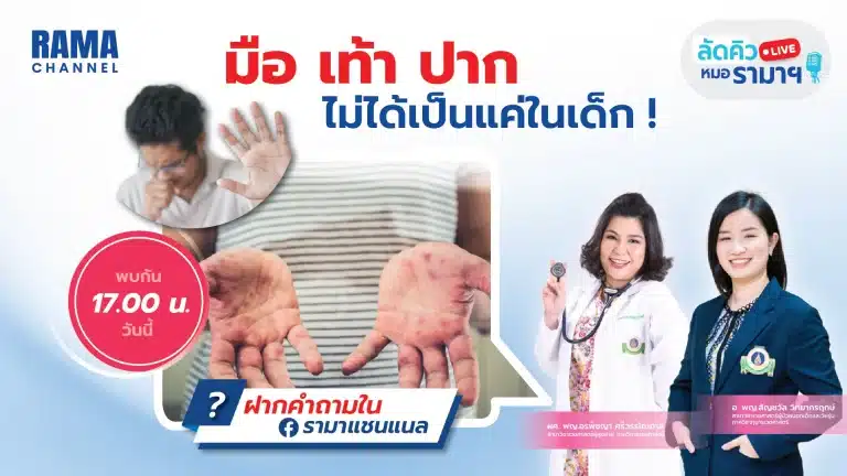 มือ เท้า ปาก ไม่ได้เป็นแค่ในเด็ก