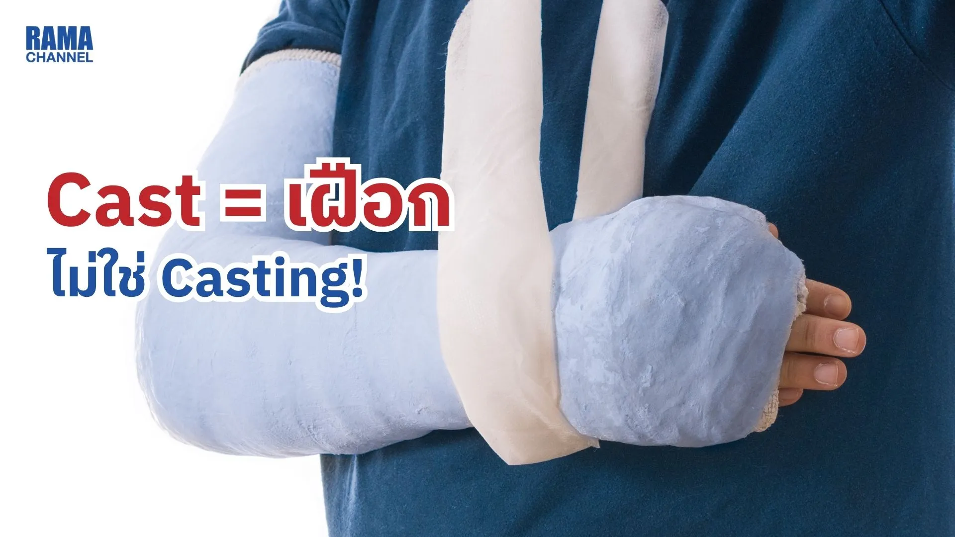 Cast = เฝือก ไม่ใช่ Casting! เข้าใจให้ถูกก่อนใช้ผิดในวงการแพทย์