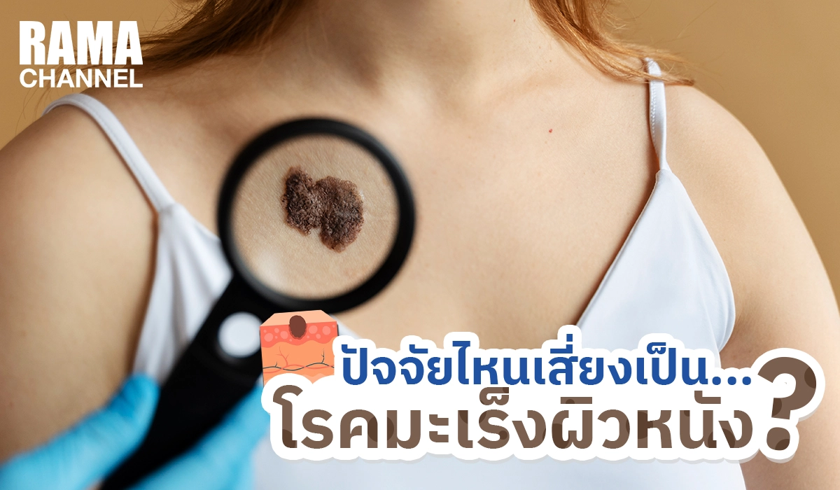 ปัจจัยไหนเสี่ยงเป็นโรคมะเร็งผิวหนัง