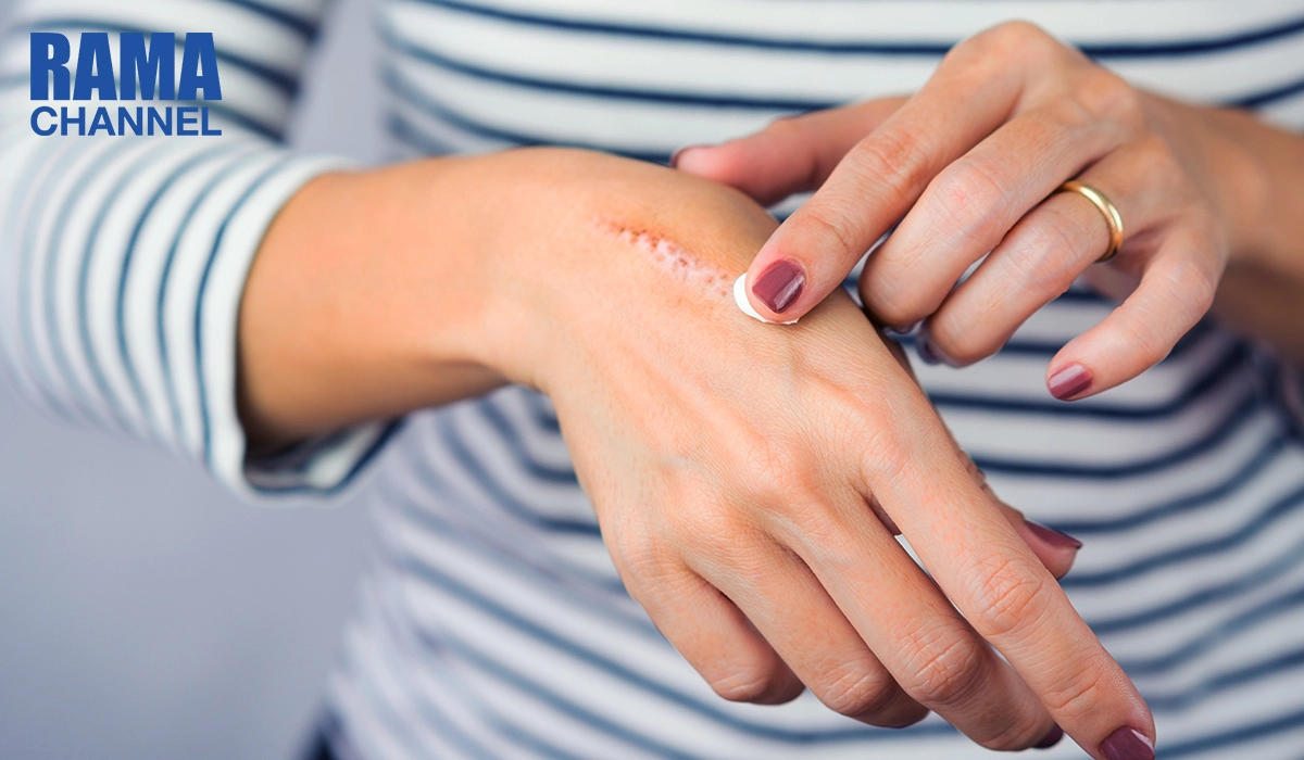 วิธีดูแลแผล เพื่อป้องกันไม่ให้เกิดรอยแผลเป็น