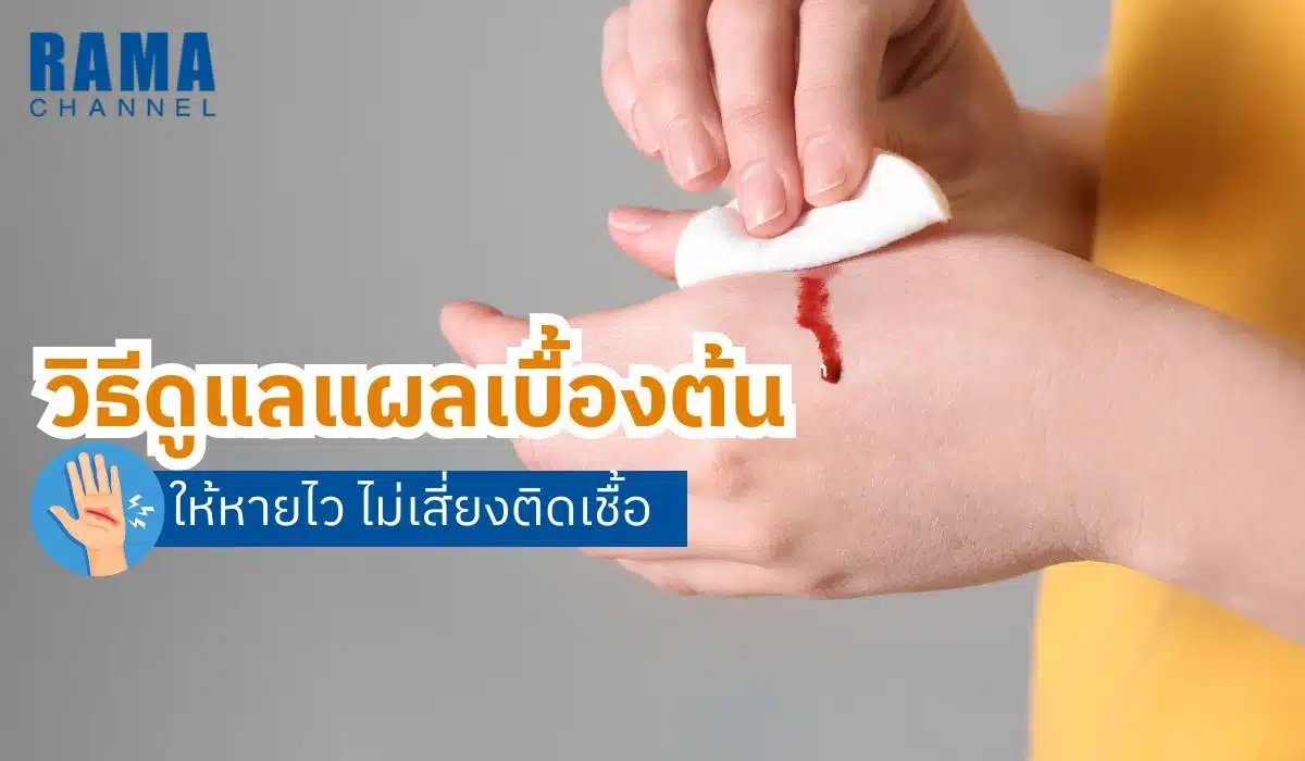 วิธีดูแลแผลเบื้องต้นให้หายไว ไม่เสี่ยงติดเชื้อ