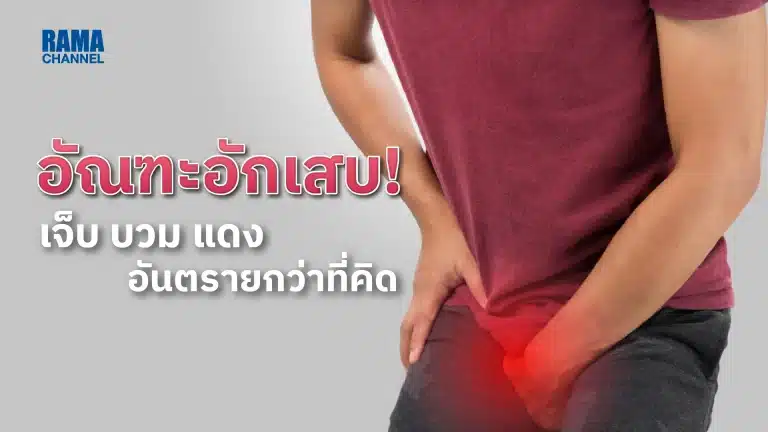 อัณฑะอักเสบ ! เจ็บ บวม แดง อันตรายกว่าที่คิด