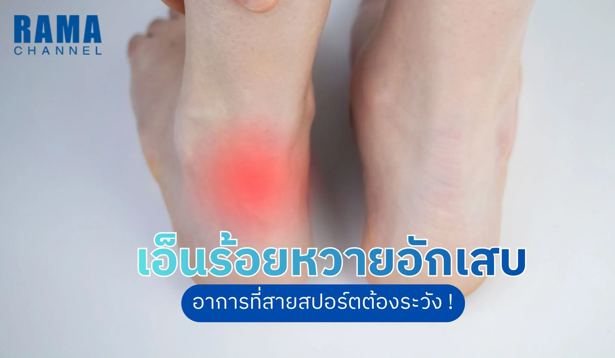 เอ็นร้อยหวายอักเสบ อาการที่สายสปอร์ตต้องระวัง