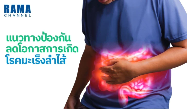 แนวทางป้องกัน ลดโอกาสการเกิด โรคมะเร็งลำไส้