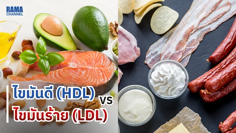 ไขมันดี (HDL) vs ไขมันร้าย (LDL) ต่างกันอย่างไร