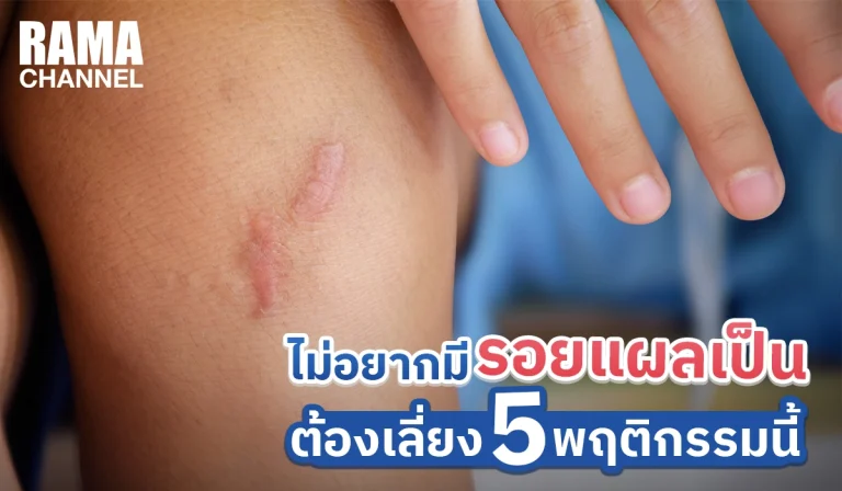 ไม่อยากมีรอยแผลเป็น ต้องเลี่ยง 5 พฤติกรรมนี้